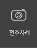 전후사진
